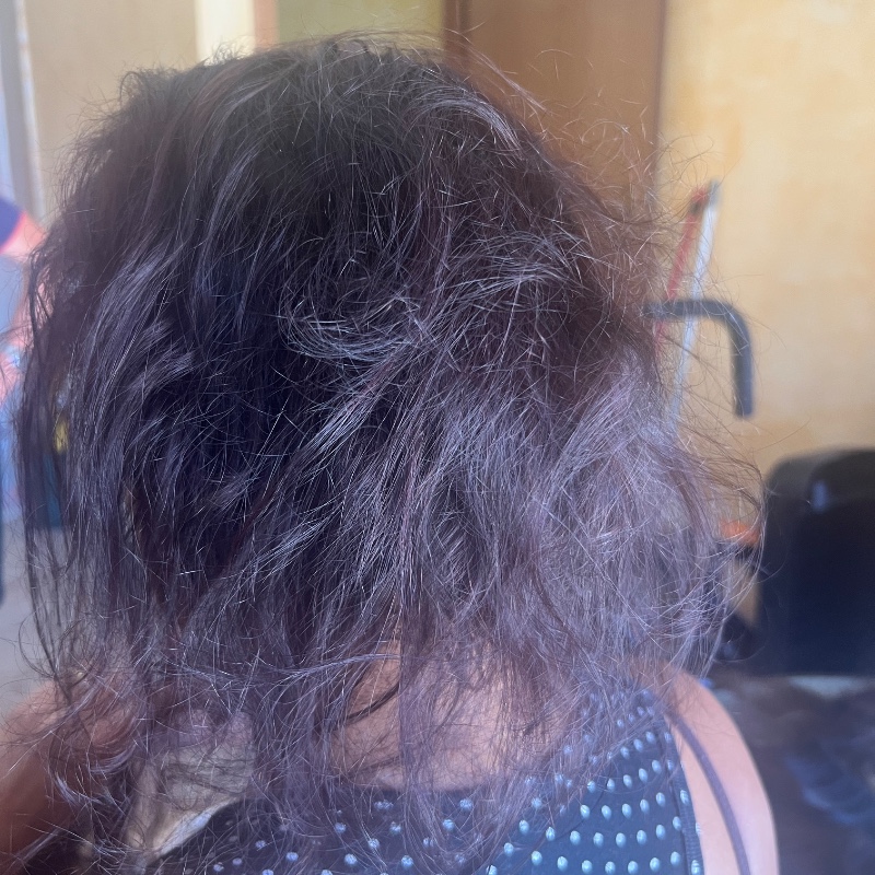 Antes: Antes do extenso